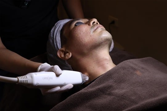Lifting treatment at Privato Clinic