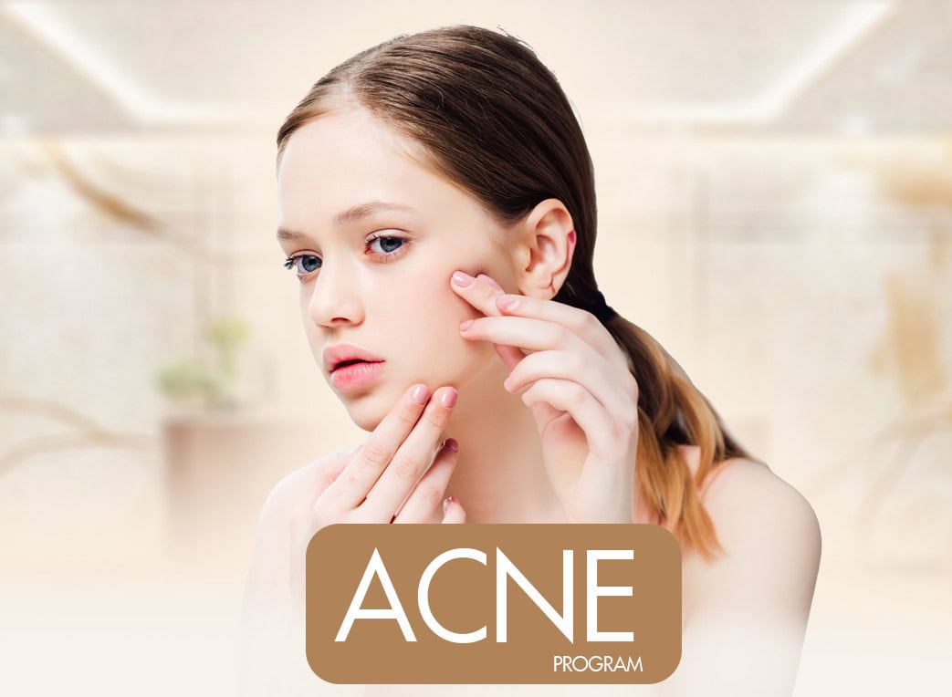 Acne Care