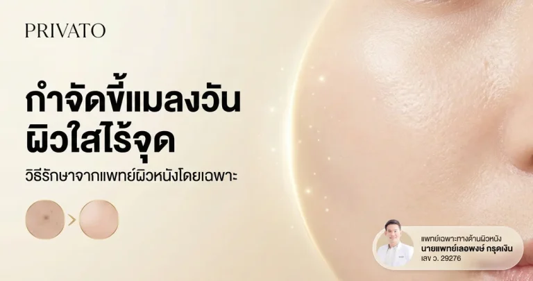 ขี้แมลงวัน เกิดจากอะไร สาเหตุและวิธีกำจัดอย่างไรให้ได้ผล