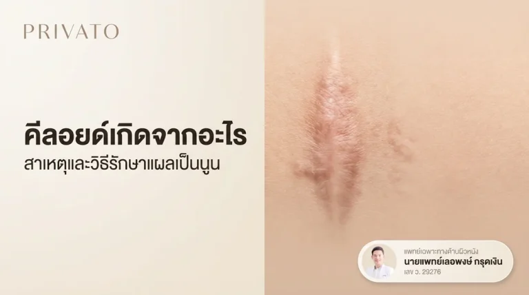 คีลอยด์เกิดจากอะไร? สาเหตุและวิธีรักษาแผลเป็นนูนที่ถูกต้อง