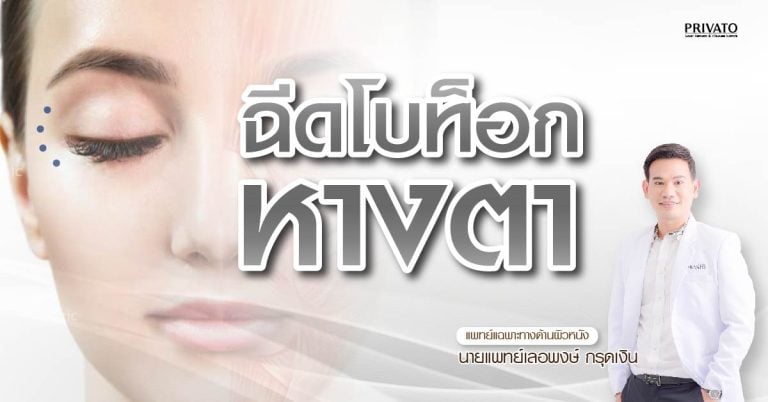 ฉีดโบท็อกซ์ยกหางตา ลดริ้วรอยตีนกา เห็นผลจริงไหม? อัปเดต 2568