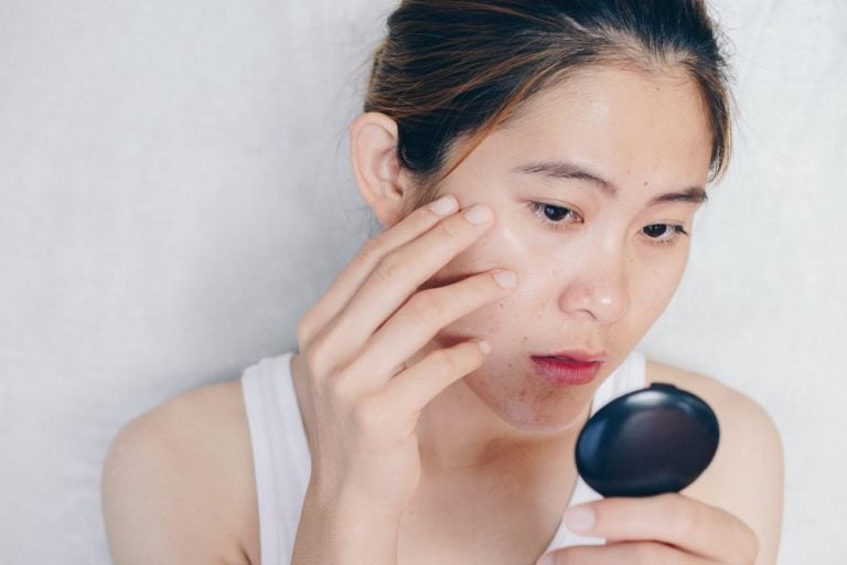 เครื่อง Pico Laser มีกี่แบบ แบบไหนเหมาะกับปัญหาผิวของคุณ ?