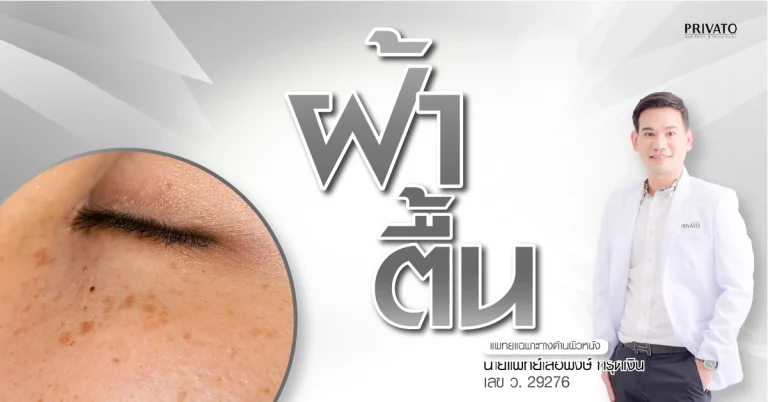 ฝ้าตื้นคืออะไร รักษาอย่างไรให้หายขาด? เจาะลึกสาเหตุและวิธีรักษา