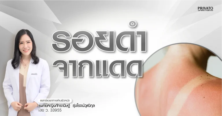 ผิวดำแดดกี่วันหาย? รวมวิธีฟื้นฟูรอยคล้ำจากแดดให้กลับมาขาวใส