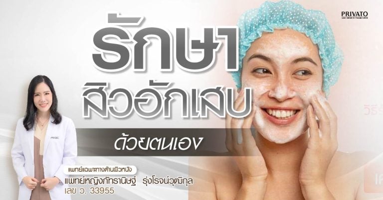 รักษาสิวอักเสบด้วยตัวเอง วิธีง่ายๆที่เห็นผล ปลอดภัย