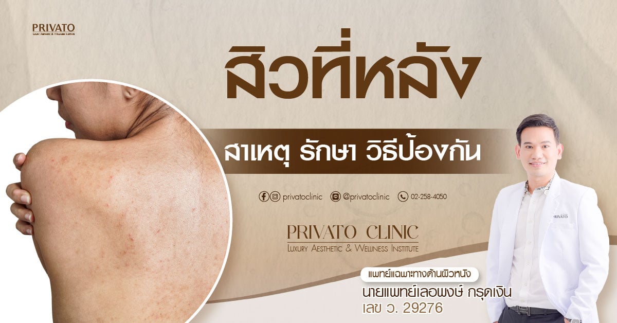 สิวที่หลัง สาเหตุ การป้องกันที่ถูกวิธี