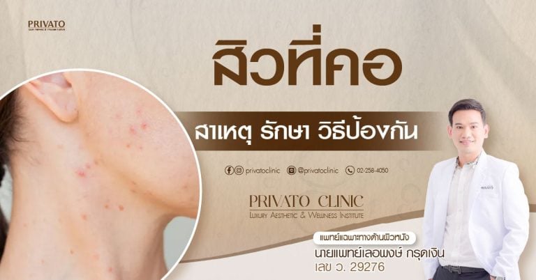 สิวที่คอ: สาเหตุ วิธีรักษา และการป้องกันที่ถูกวิธี