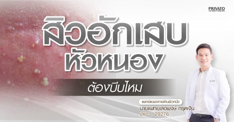 สิวอักเสบหัวหนอง ต้องบีบไหม คำตอบชัด พร้อมวิธีดูแลที่ถูกต้อง