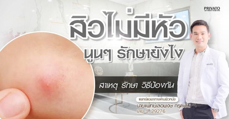 สิวไม่มีหัว นูนๆ ดูแลและรักษายังไงให้ยุบไว