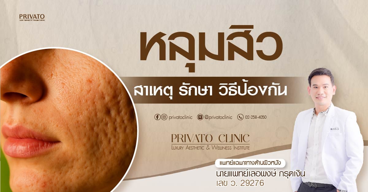 หลุมสิวเกิดขึ้นได้อย่างไรและรักษาแบบไหน