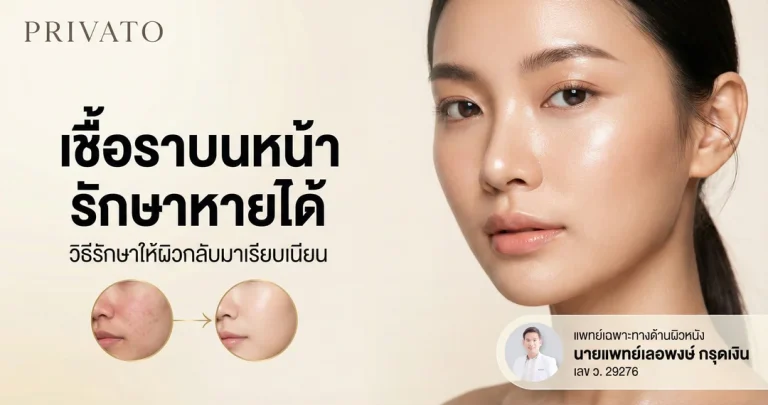 เชื้อราบนหน้า สาเหตุ อาการ และวิธีรักษาให้ผิวกลับมาเรียบเนียน