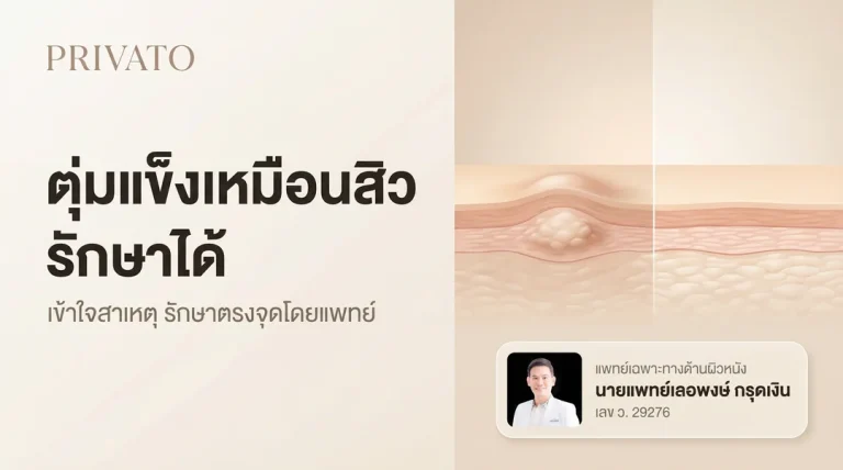 เป็นตุ่มแข็งเหมือนสิว: สาเหตุ อาการ และวิธีรักษาที่ถูกต้อง