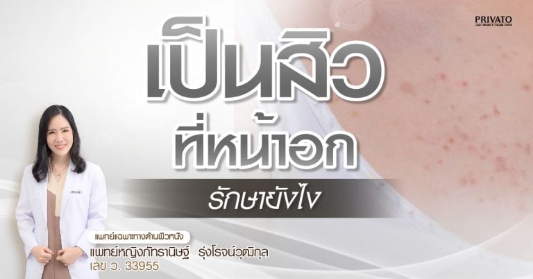 เป็นสิวที่หน้าอก รักษายังไง คู่มือเช็คสาเหตุและการดูแลอย่างได้ผล