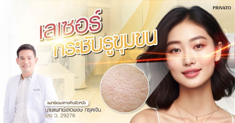 เลเซอร์กระชับรูขุมขนเหมาะกับใคร มีแบบไหนบ้าง ต้องทำกี่ครั้ง เห็นผลตอนไหน
