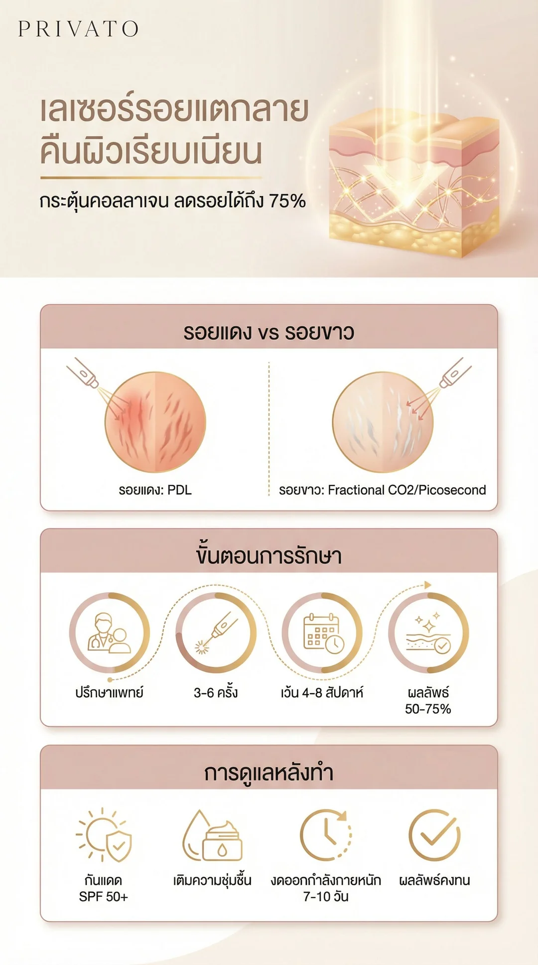 เลเซอร์รอยแตกลาย คืนผิวเรียบเนียน เห็นผลจริงไหม ราคาเท่าไหร่ Infographic