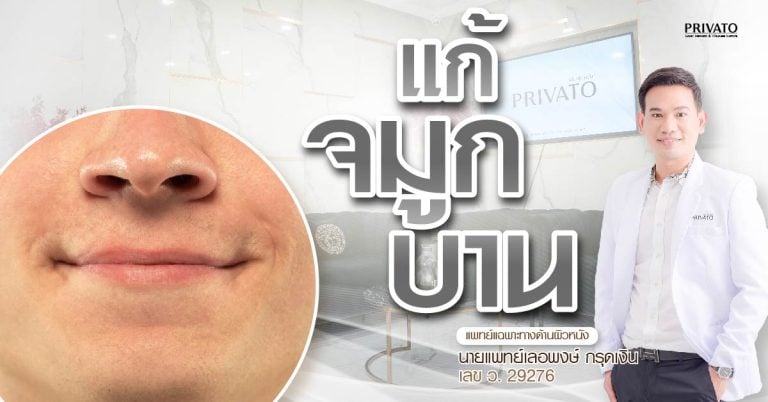 แก้จมูกบาน วิธีไหนดี? เปรียบเทียบชัดๆ ระหว่างศัลยกรรม vs ไม่ศัลยกรรม