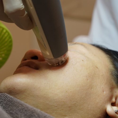 ลูกค้ากำลังเข้ารับบริการโปรแกรมเลเซอร์หลุมสิว eMatrix(Close-up2)